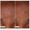 Woman's skin before and after Urban Skin RX HyperCorrect Intense Fading Cream with visibly improved skin