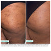 Fade Fix Bump & Dark Spot 10% AHA Exfoliating Solution