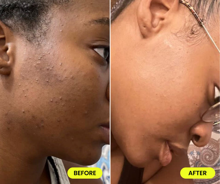 before and after image